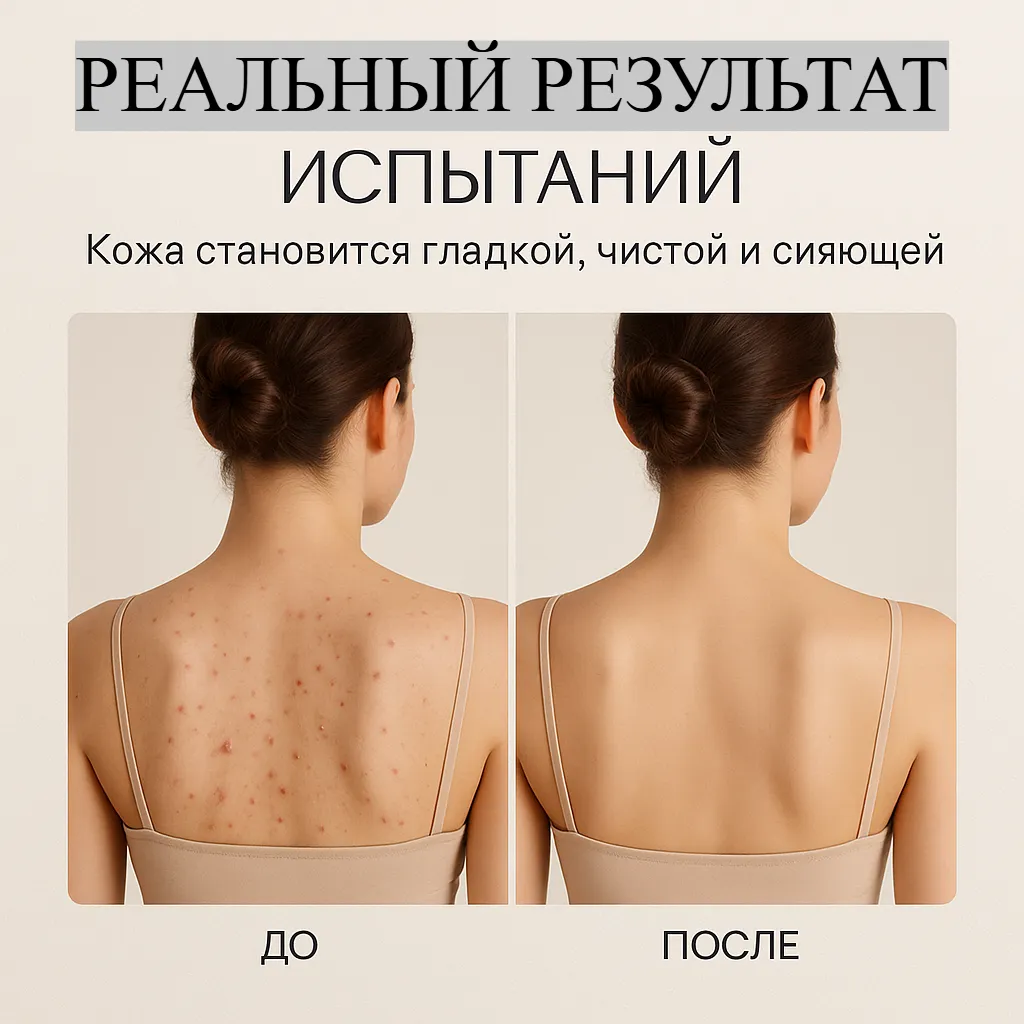 Гель для душа против угрей и акне