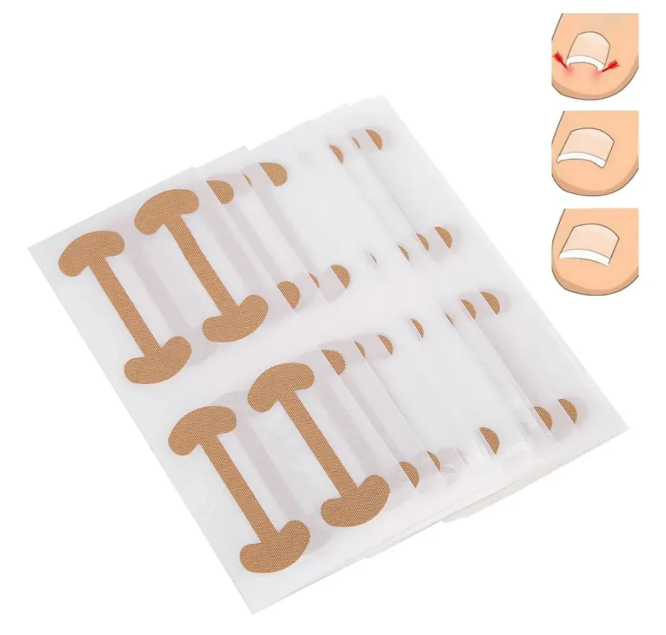 Пластыри для коррекции вросших ногтей