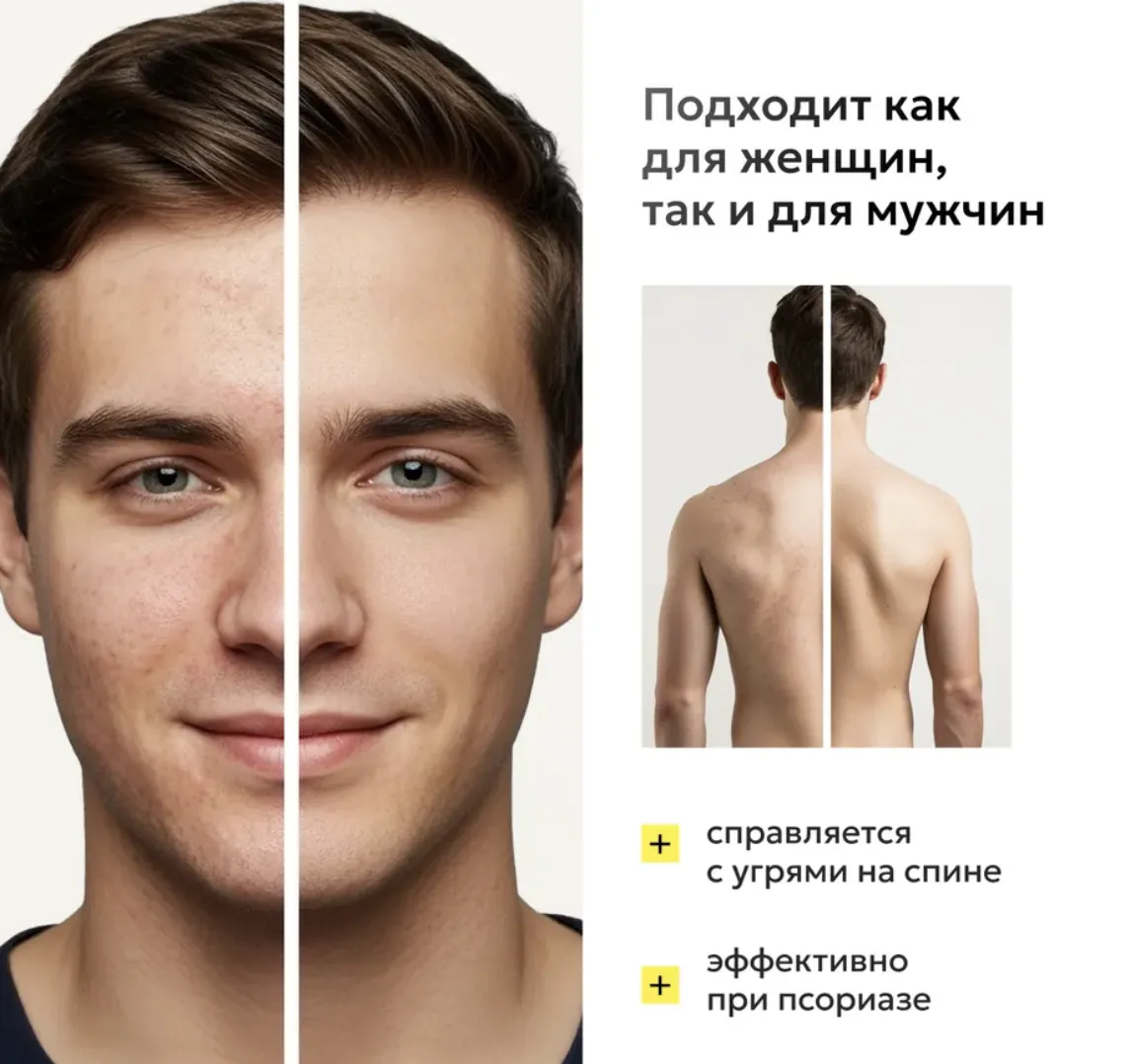 Отбеливающее мыло для сияющей кожи