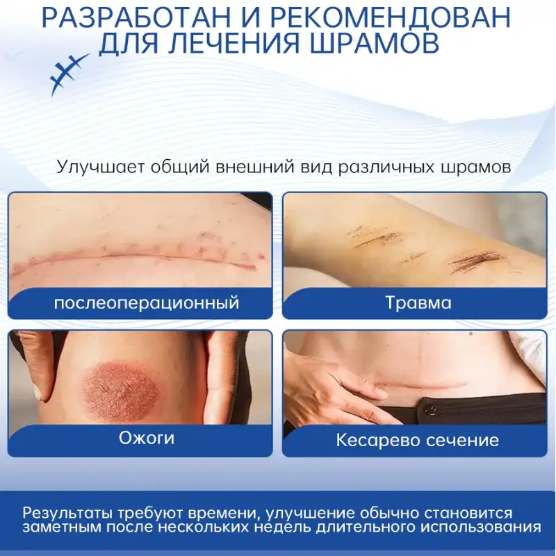 Эффективное восстановление