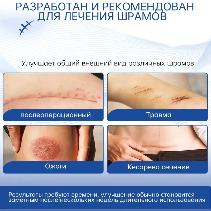 Крем MEJISOO от шрамов, рубцов и растяжек с натуральными экстрактами