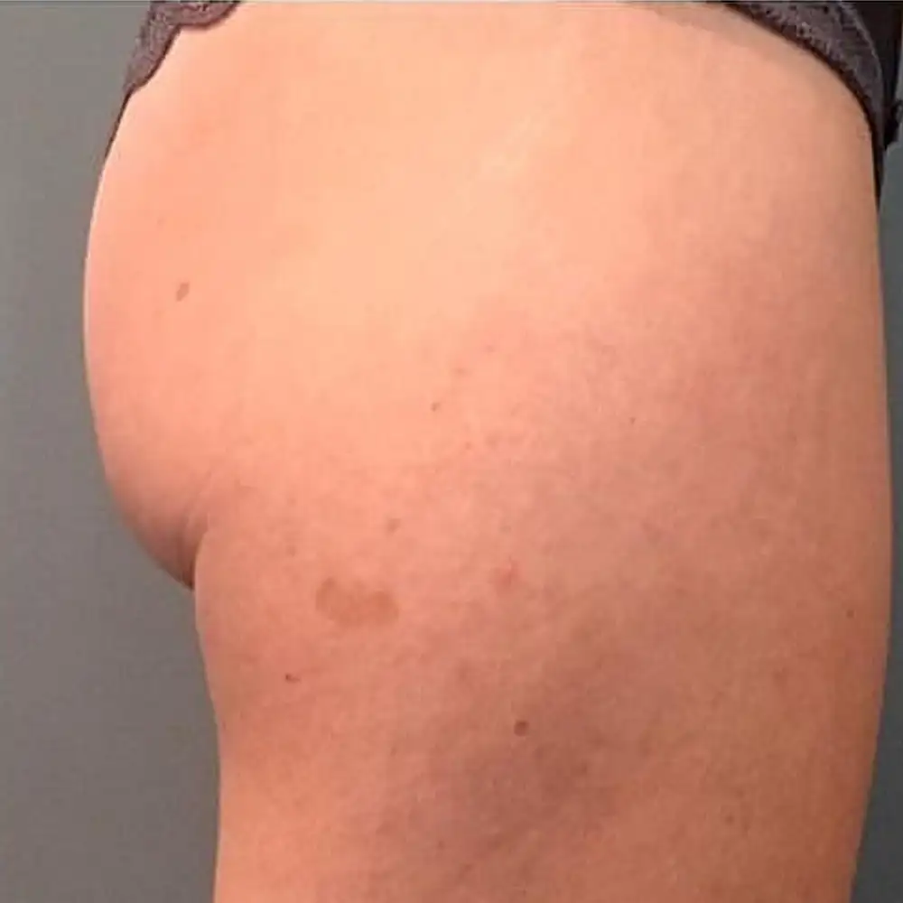 Фото товара: