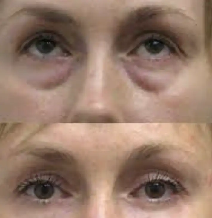 Фото товара: