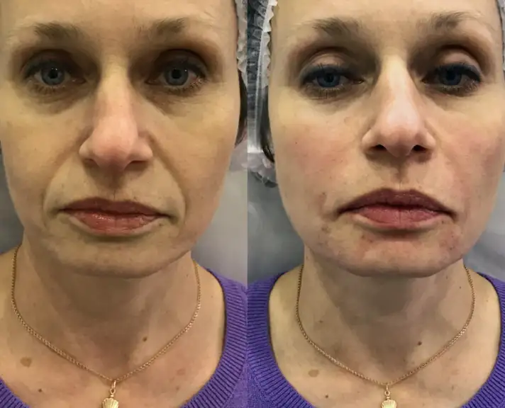 Фото товара: