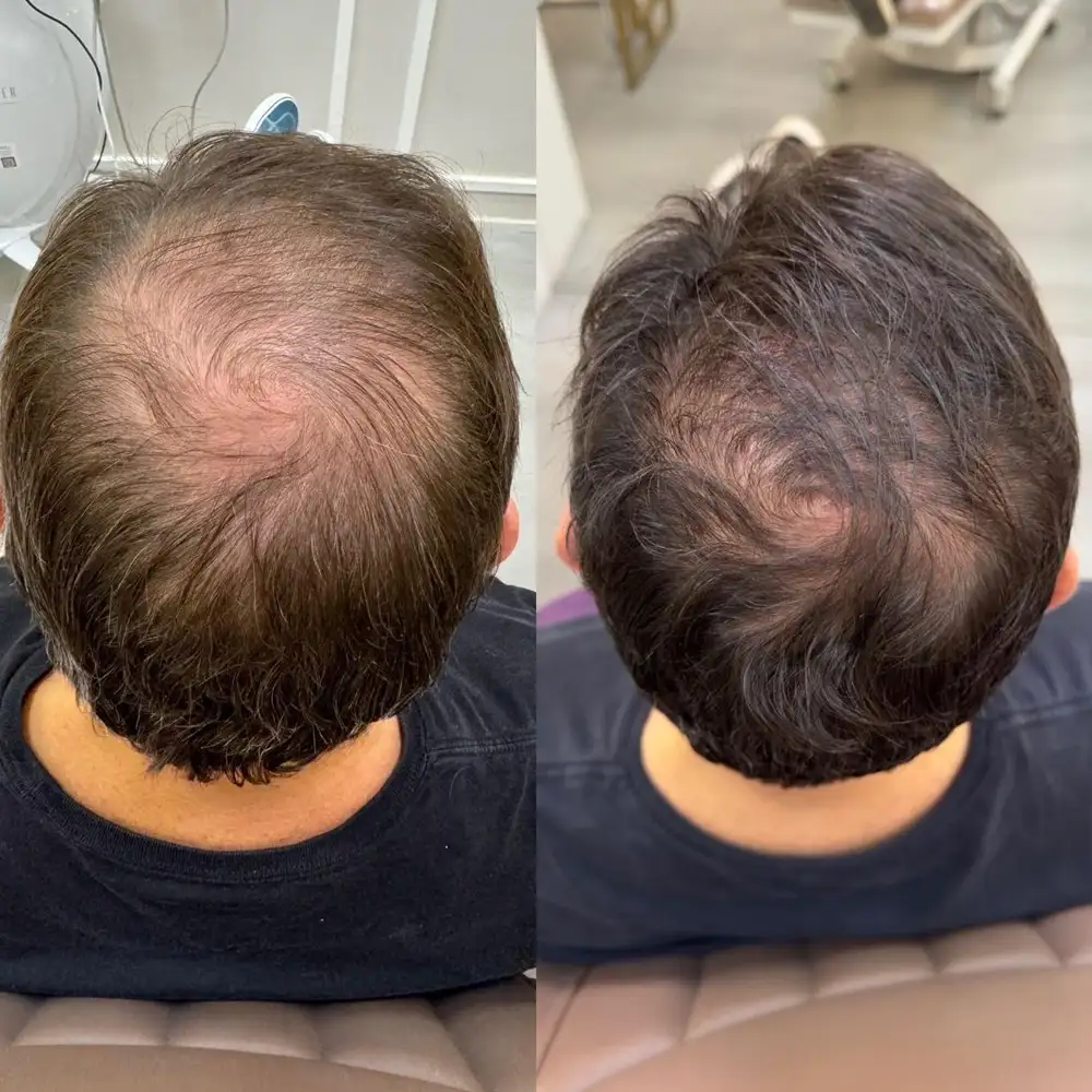 Фото товара: