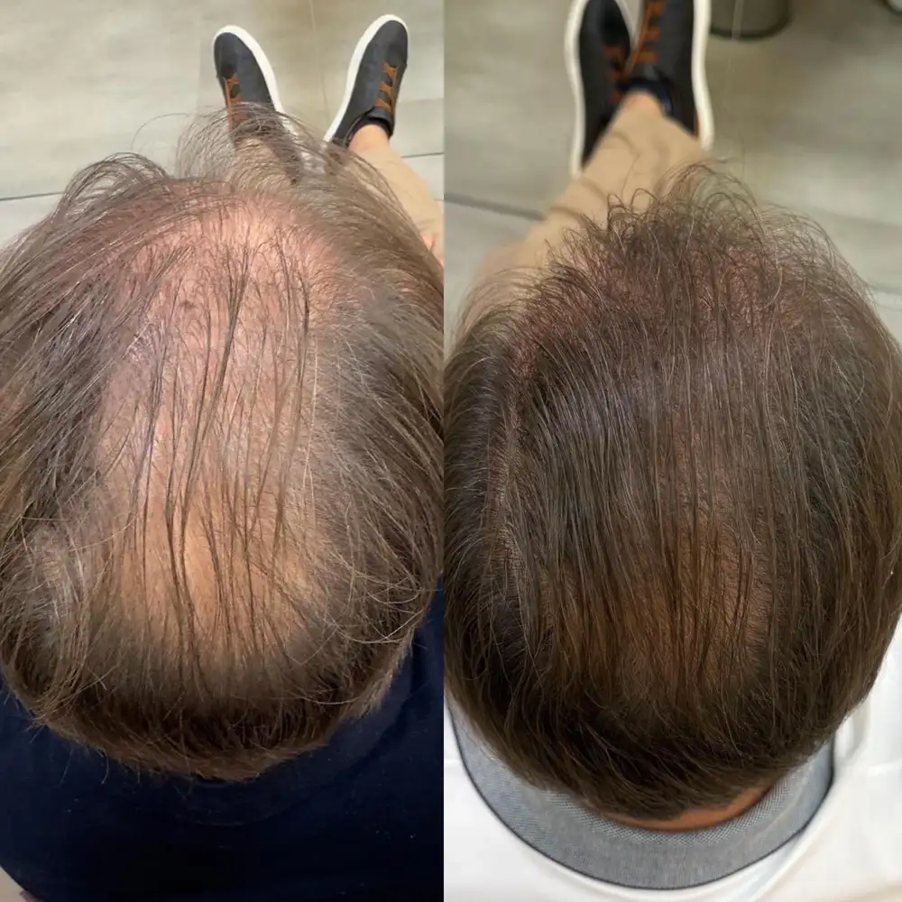 Фото товара: