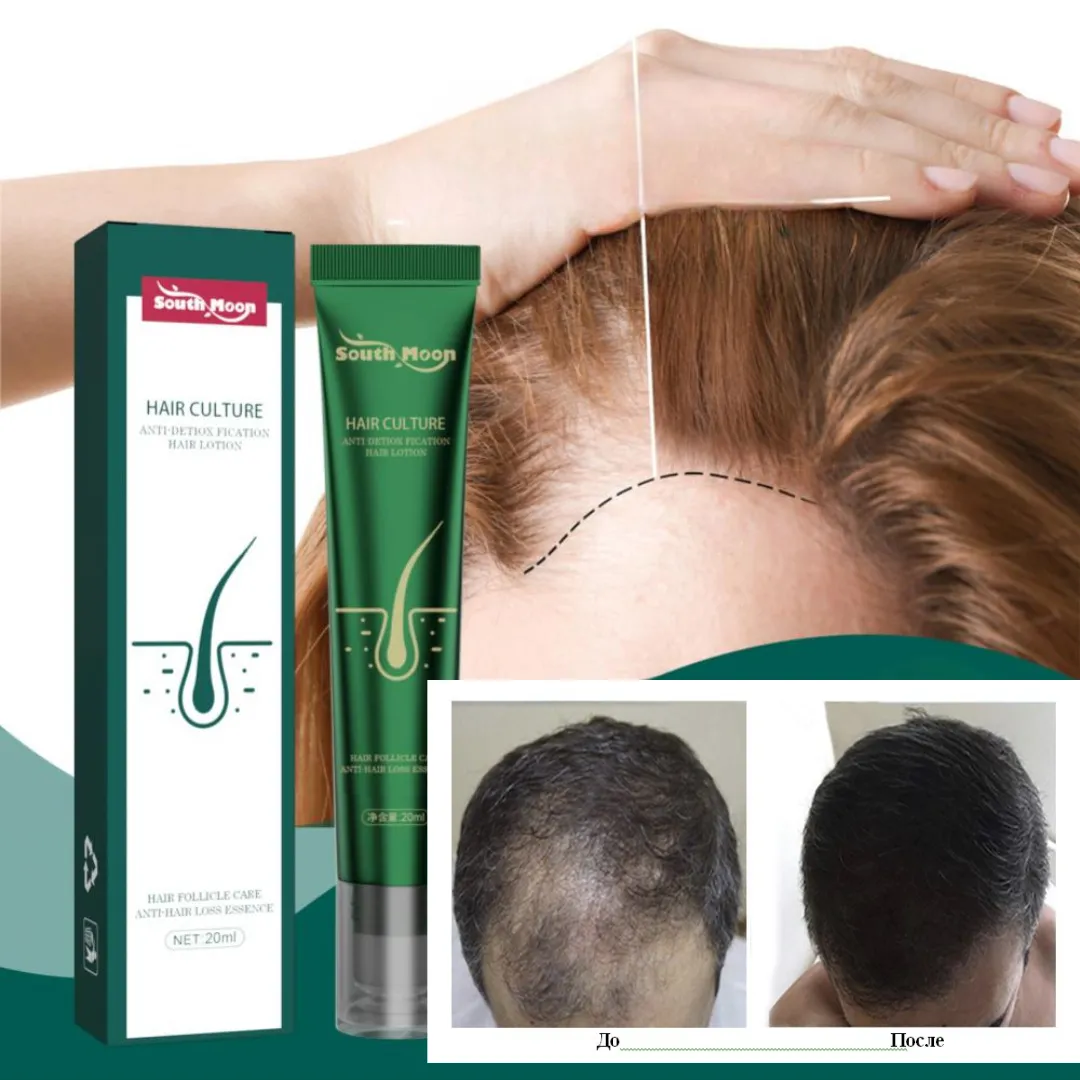 Сыворотка South Moon Hair Culture против выпадения волос и для роста волос