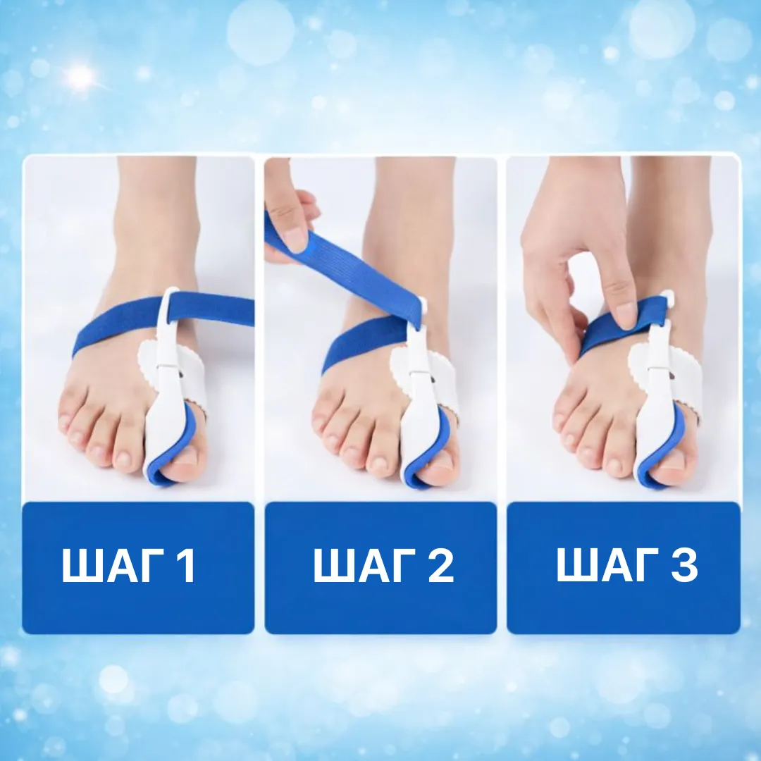 вальгусный корректор