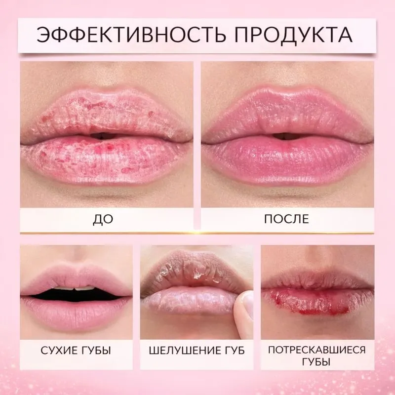 Сыворотка для объема губ — эффект до и после, увеличение и увлажнение губ