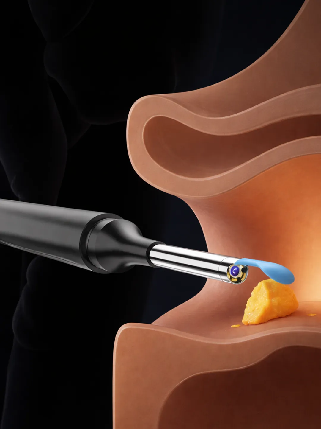 Устройство для удаления ушной серы со встроенной камерой