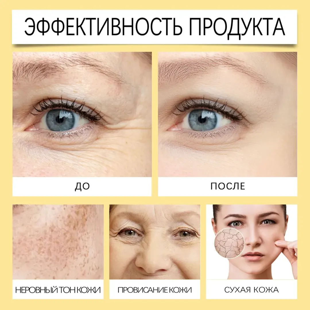 Furzero — крем для разглаживания морщин