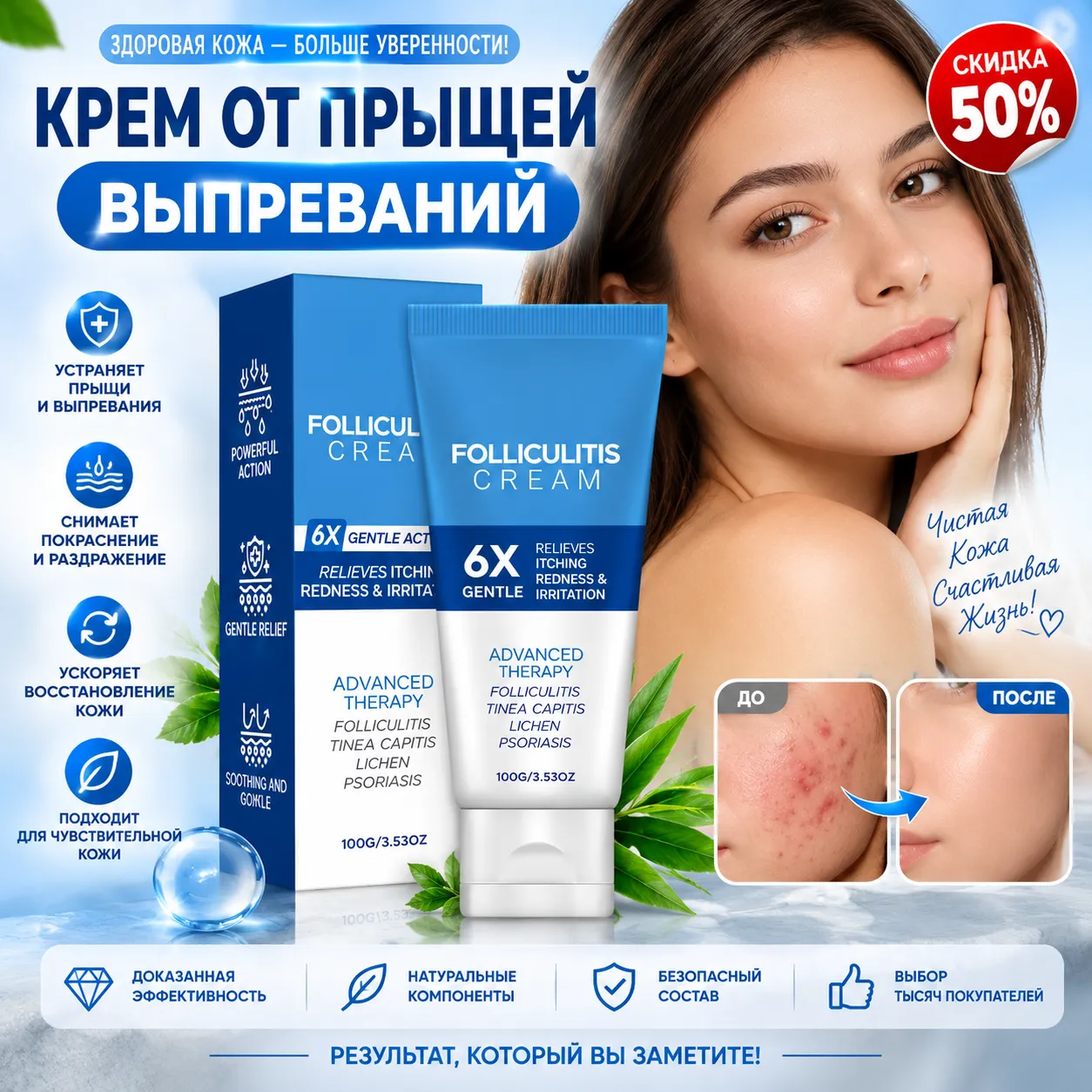 Крем от прыщей и выпреваний 100 г для ухода за раздражённой кожей