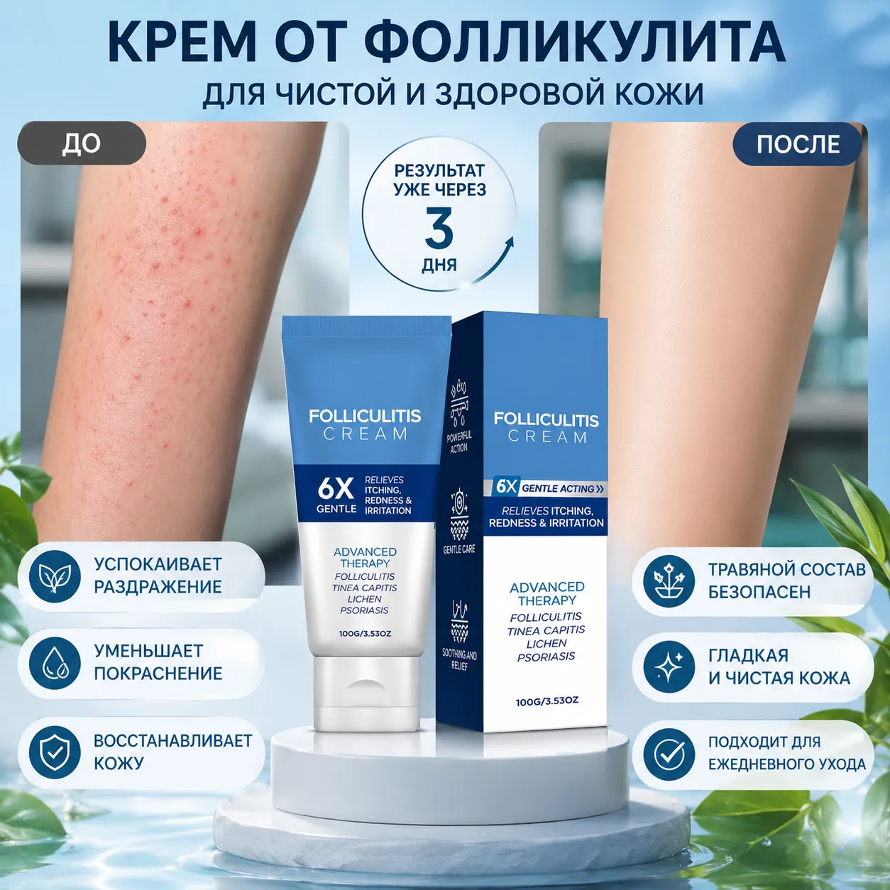 Крем от прыщей и выпреваний 100 г для ухода за раздражённой кожей