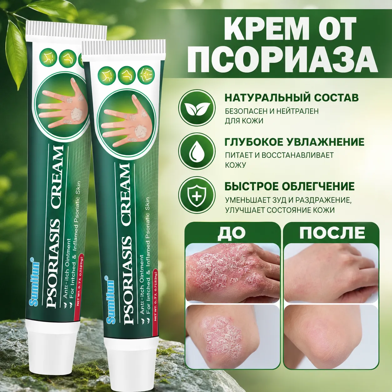 крем от псориаза