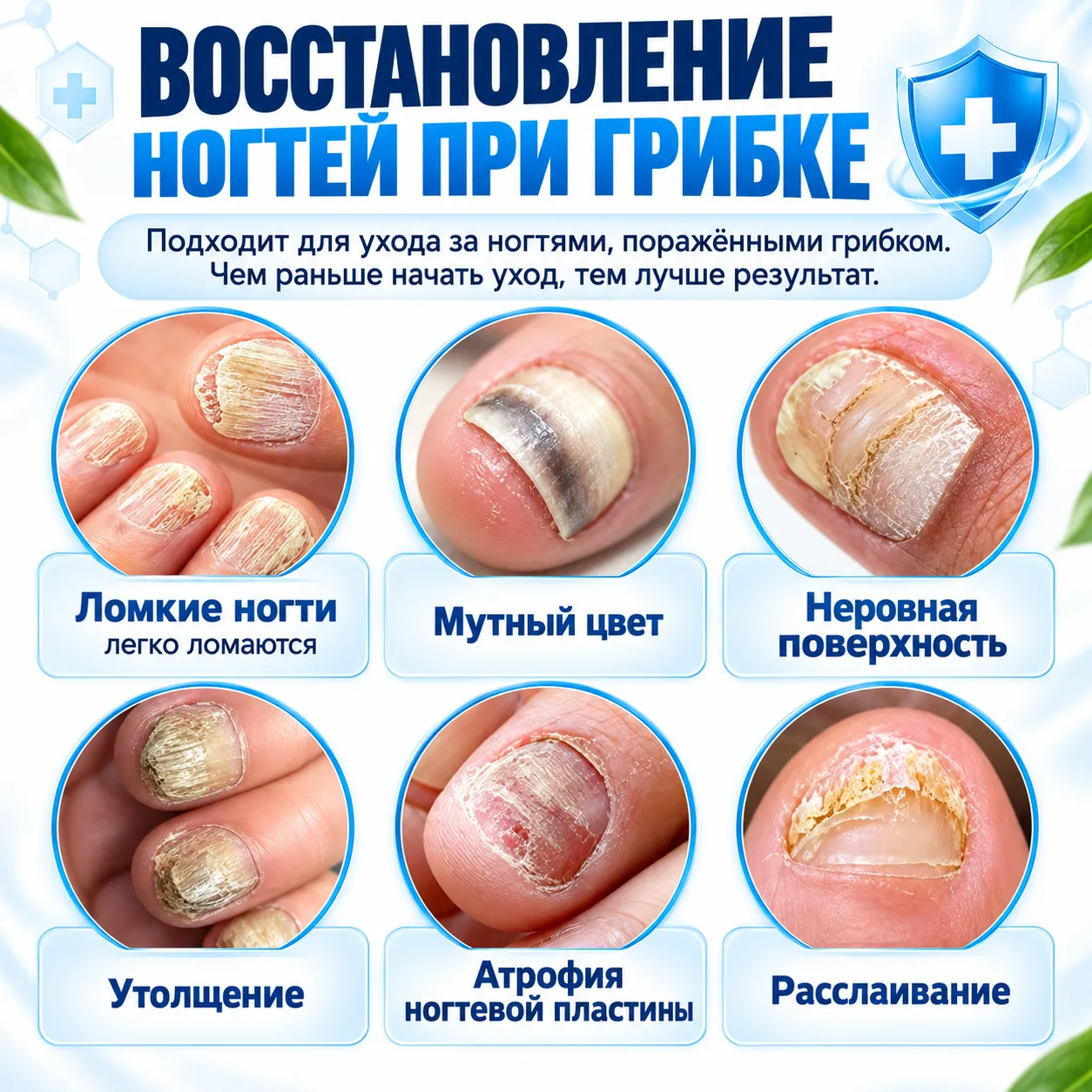 спрей от грибка