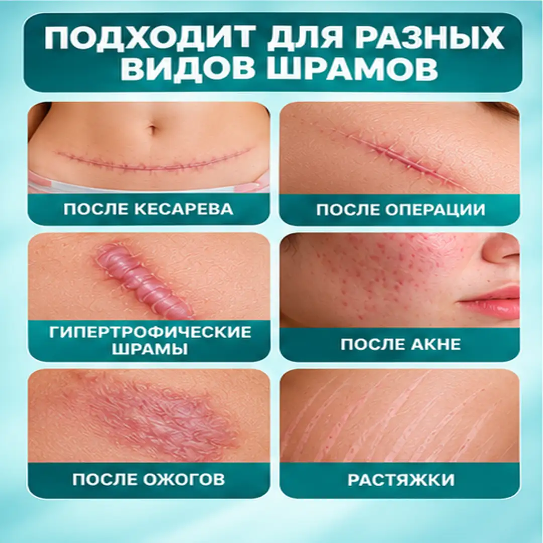 Уход за проблемными участками кожи
