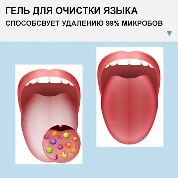 Набор для чистки языка