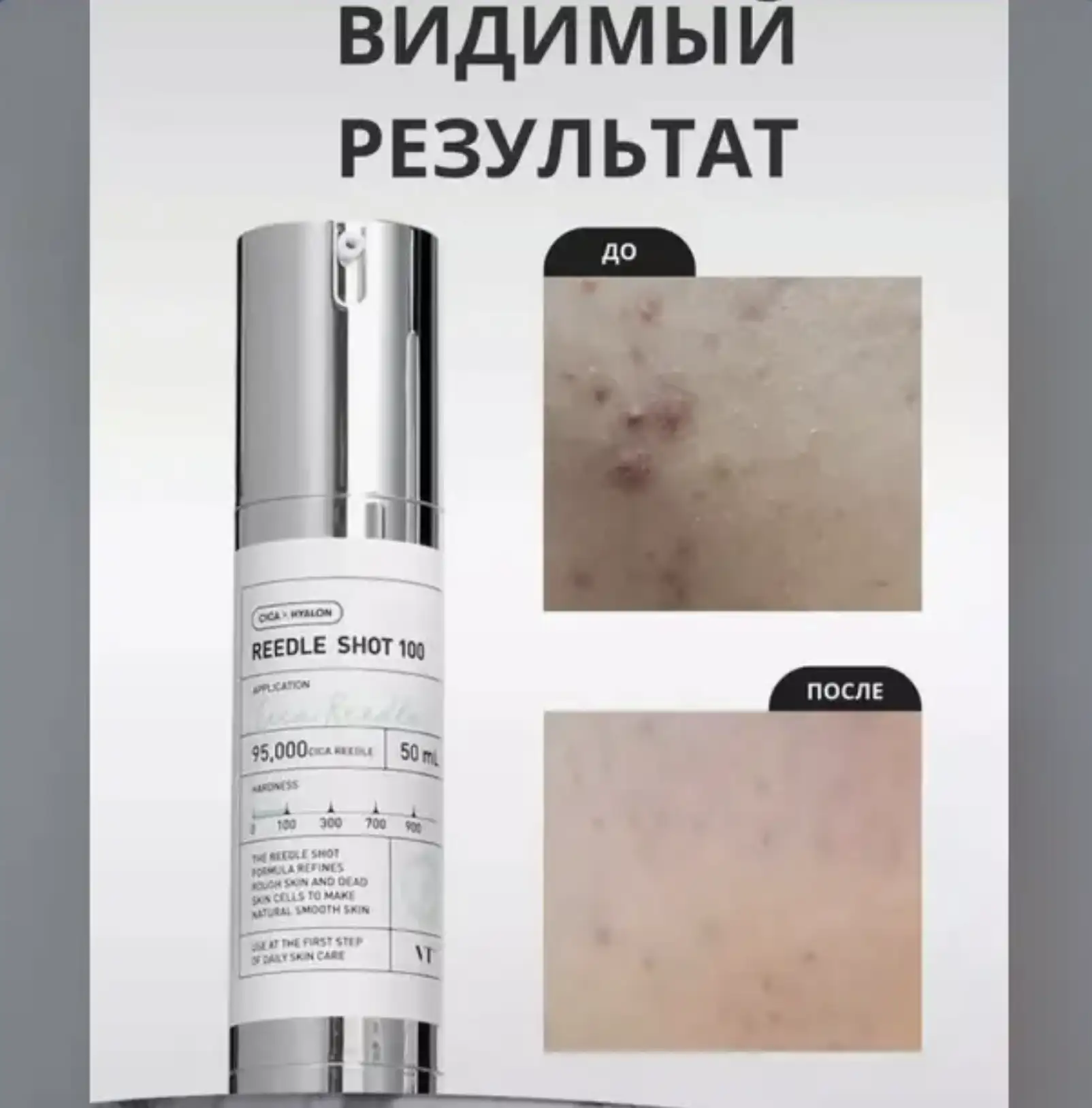 💧 Омоложение без инъекций и салонов