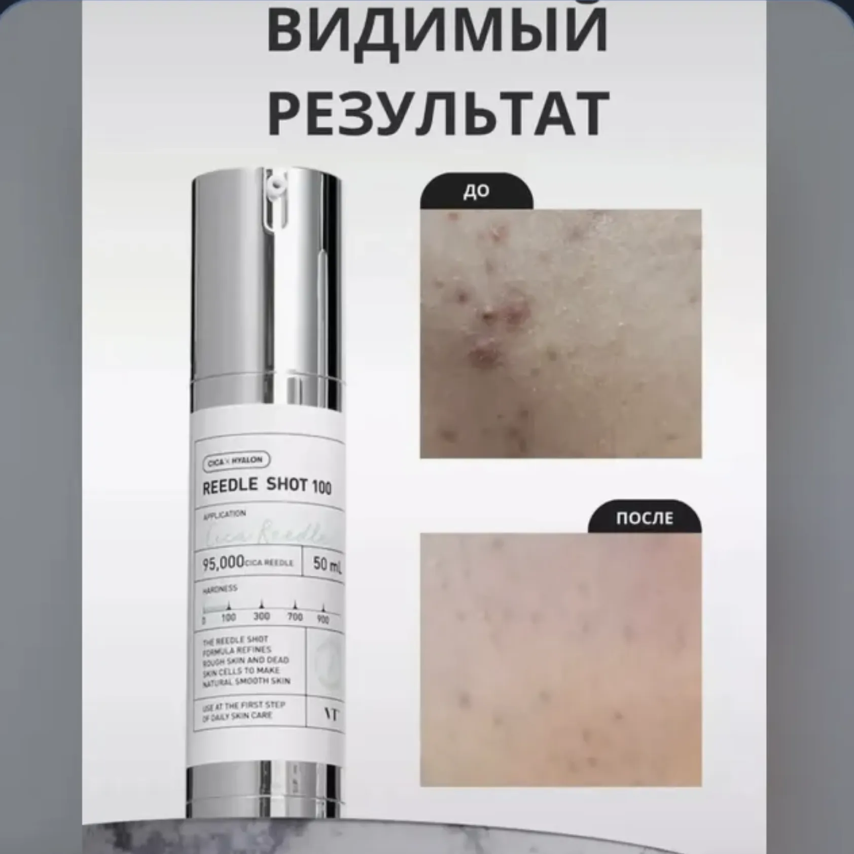 Сыворотка для лица REEDLE SHOT
