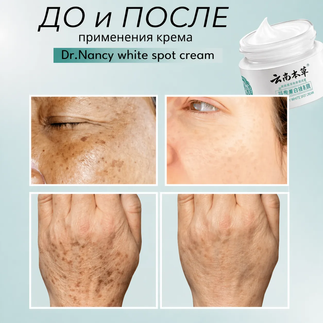 Отбеливающий крем для кожи