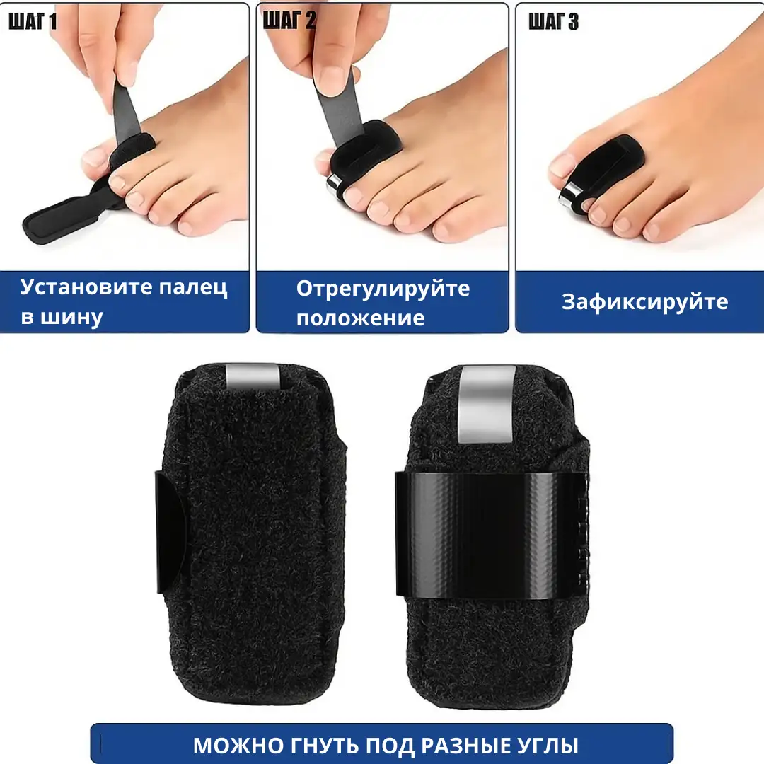 Установка