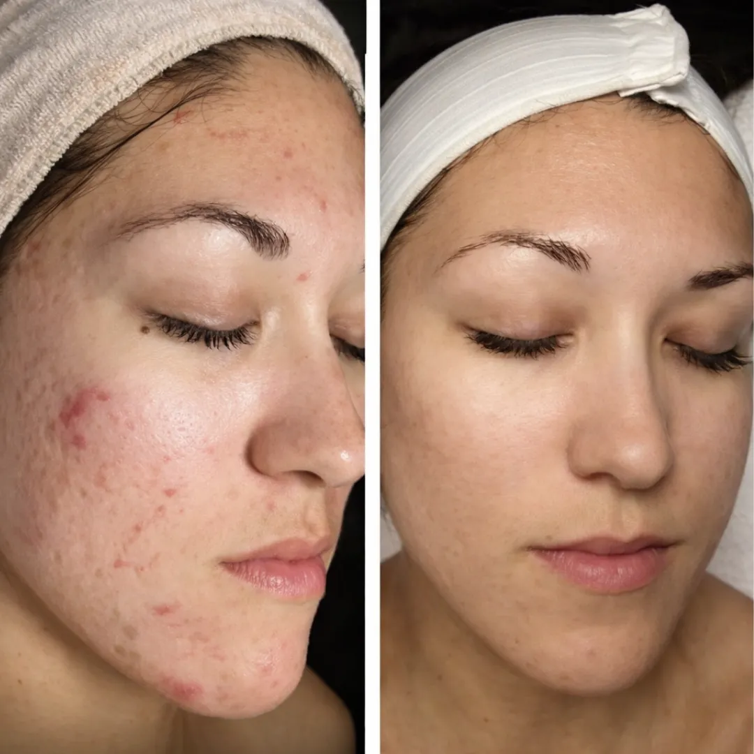 Маска-плёнка для сужения пор с коллагеном