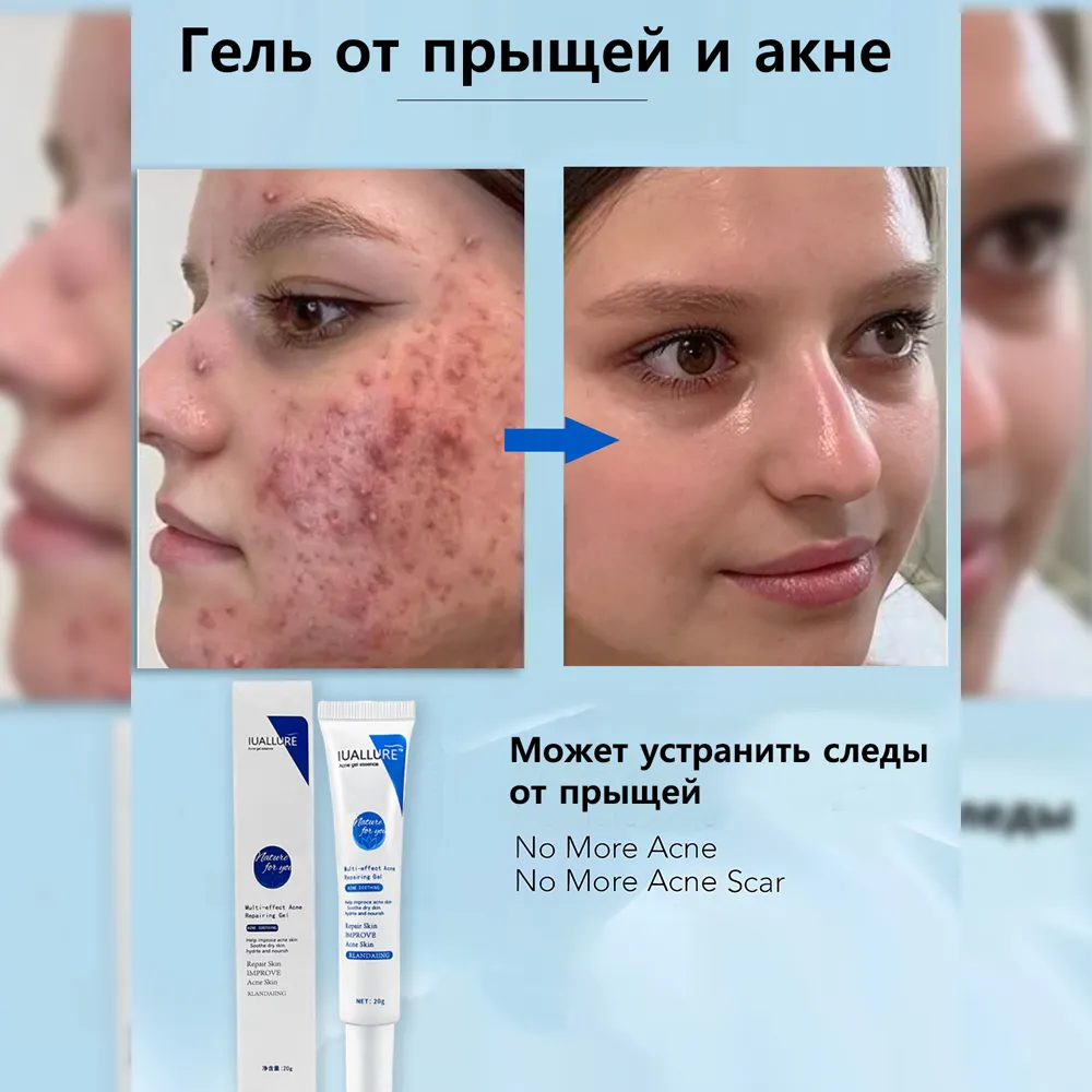 Очищающий гель против акне